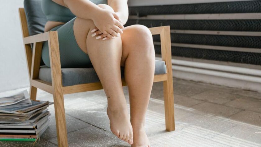 Can Lipedema Be Prevented